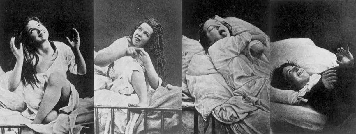 十九世紀末，法國醫院內接受醫生催眠的「歇斯底里」婦女。