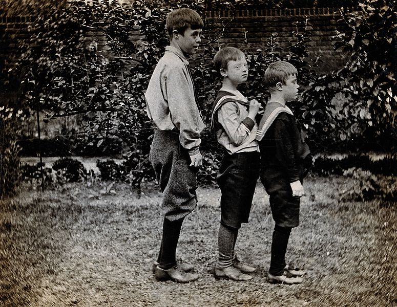 三個唐氏症男孩，攝於1902年。