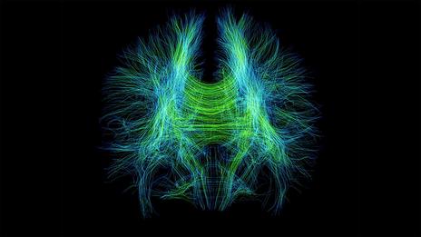 腦神經纖維，如這張磁核共振造影（MRI）掃描可見，可能藏有憂鬱症的物理線索。